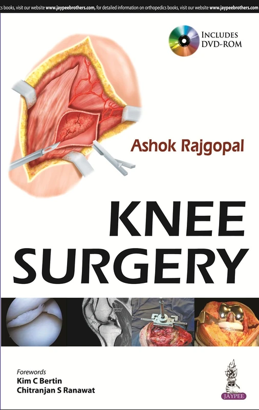 Knee Surgery by Jaypee Brothers Medical Publishers - Guide - Image 1