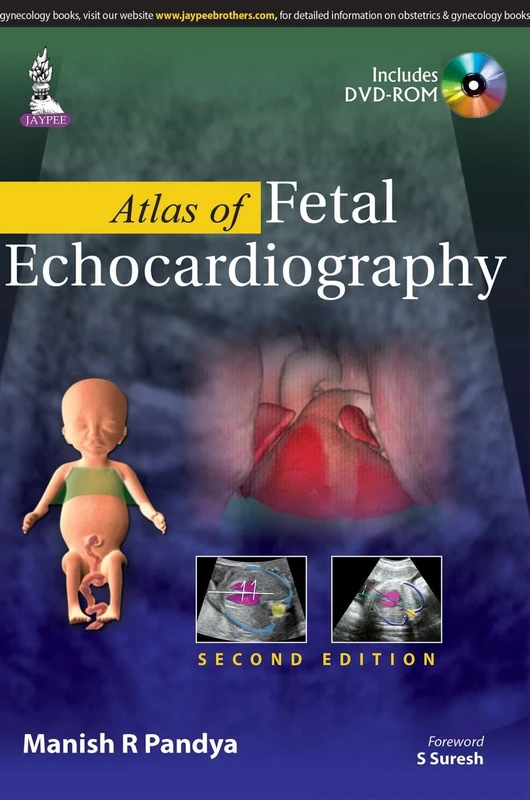 Atlas of Fetal Echocardiography
