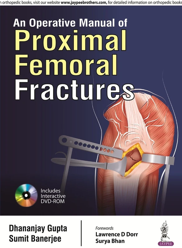 An Operative Manual of Proximal Femoral Fractures