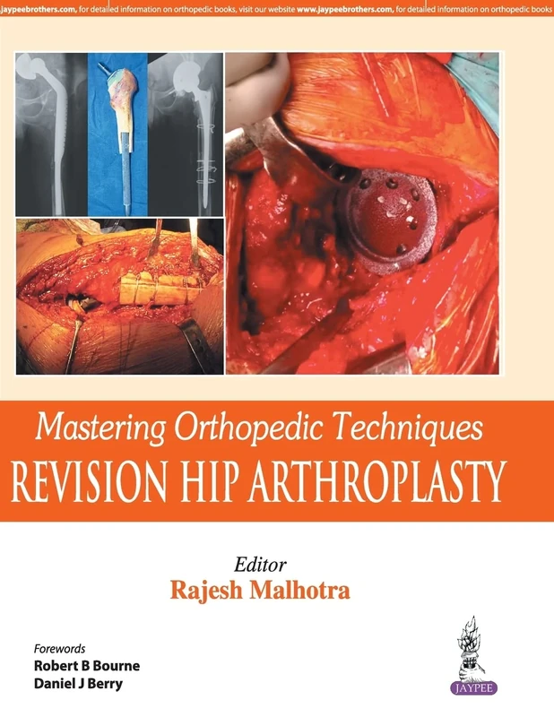 Mastering Orthopedic Techniques: Revision Total Hip Arthroplasty: Revision Hip Arthroplasty