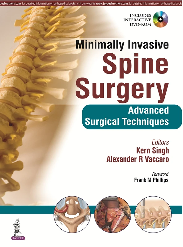 Minimally Invasive Spine Surgery: Techniques, Evidence, & Controversies