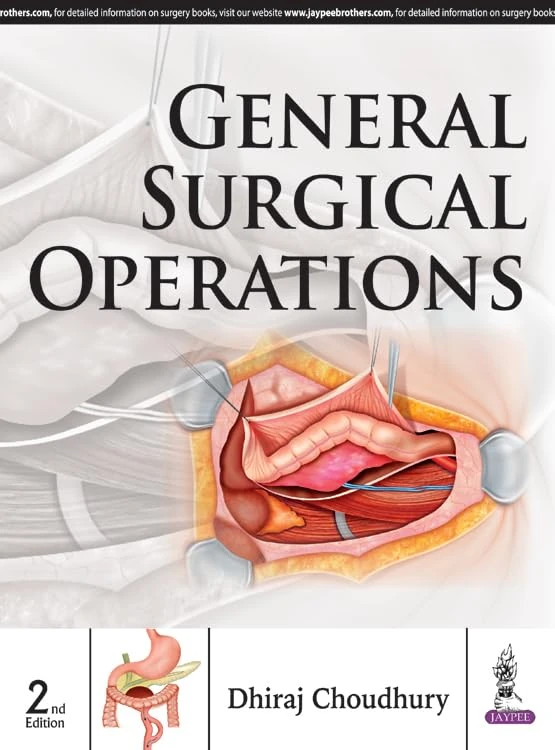 General Surgical Operations