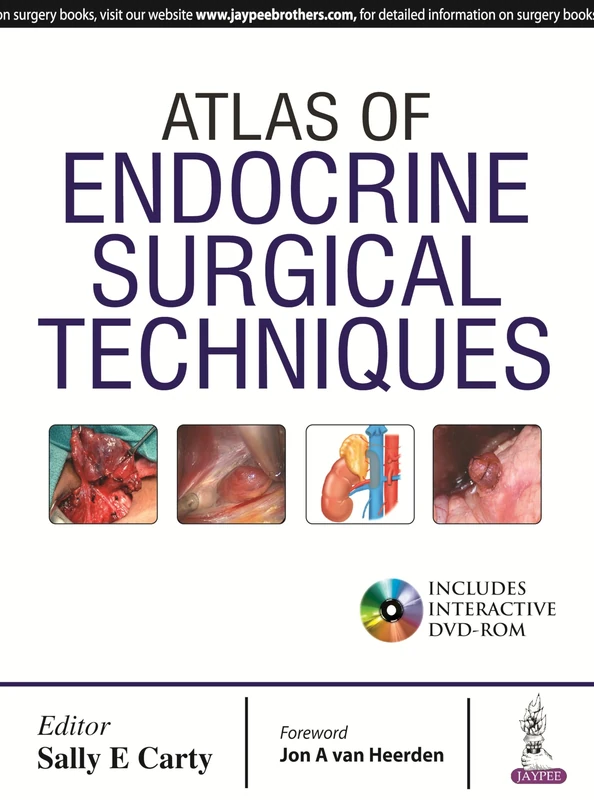 Atlas of Endocrine Surgical Techniques - Jaypee Brothers