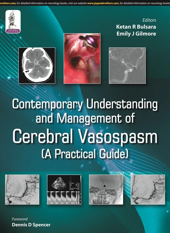 Contemporary Understanding & Management of Cerebral Vasospasm