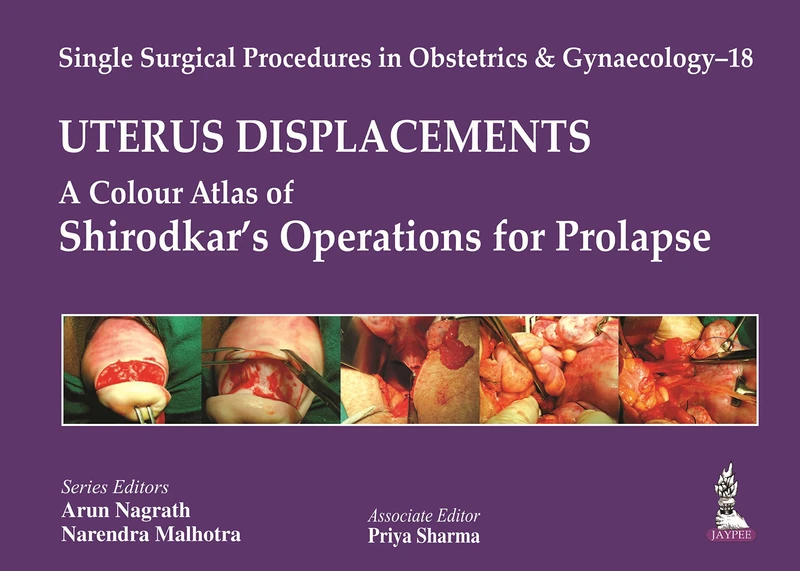 Single Surgical Procedures in Obstetrics and Gynaecology - 18 Uterus Displacements: A Colour Atlas of Shirodkar's Operations for Prolapse