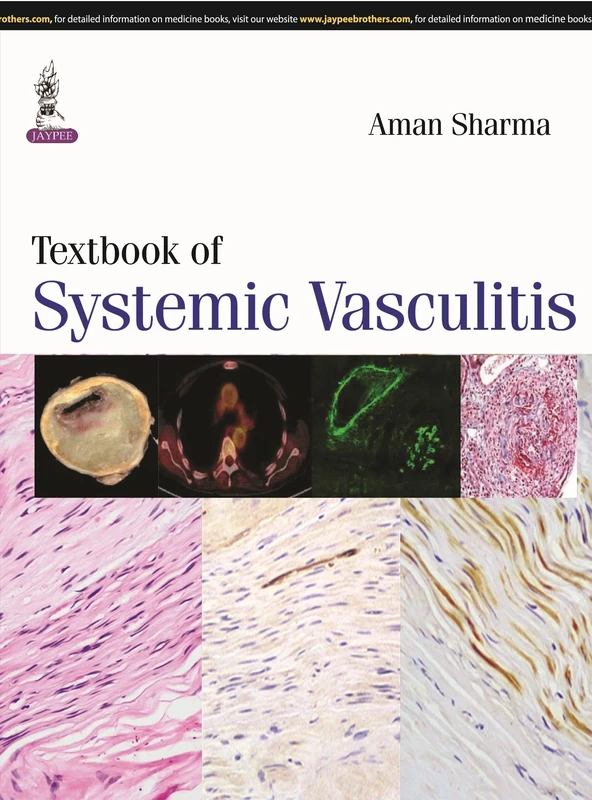 Textbook of Systemic Vasculitis