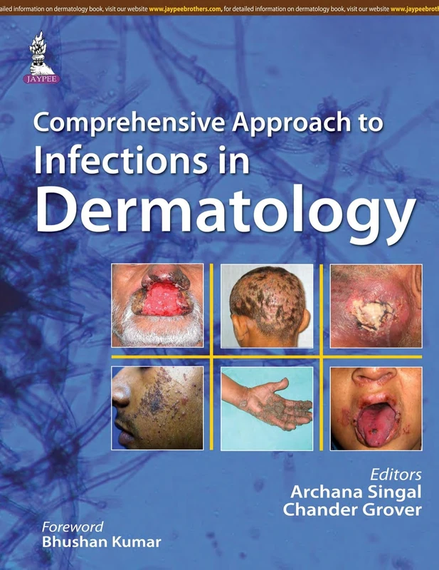 Comprehensive Approach to Infections in Dermatology