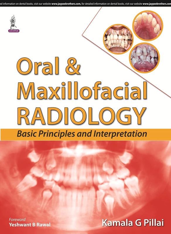 Oral & Maxillofacial Radiology: Basic Principles and Interpretation