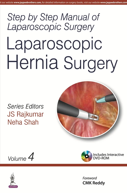 Laparoscopic Hernia Surgery