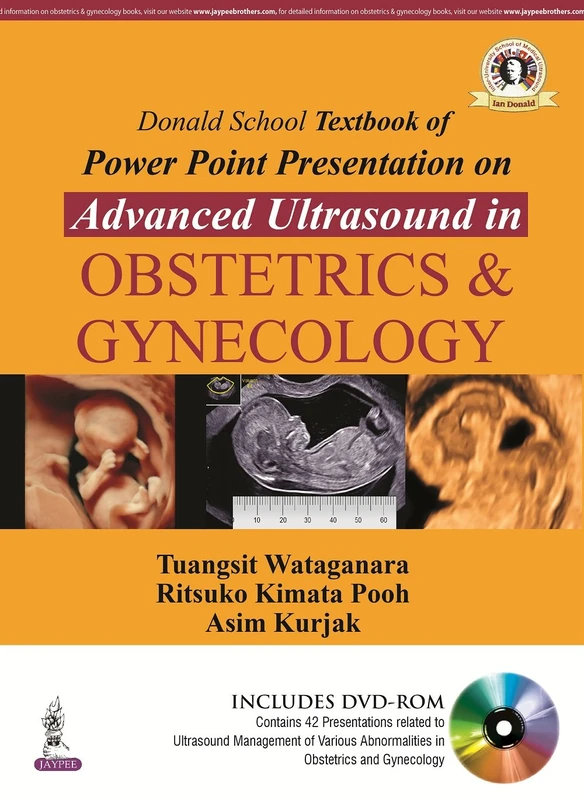 Donald School Textbook of Powerpoint Presentation on Advanced Ultrasound in Obstetrics & Gynecology