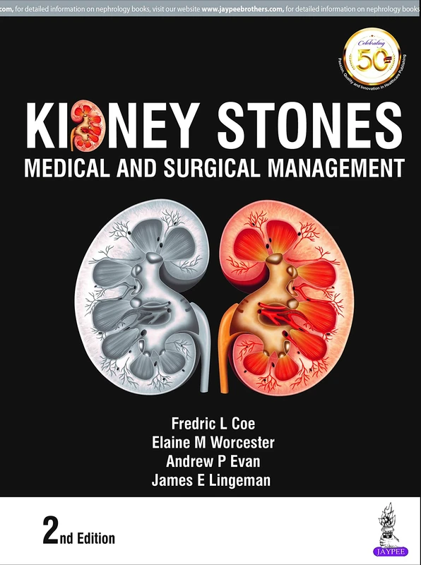 Kidney Stones: Medical and Surgical Management