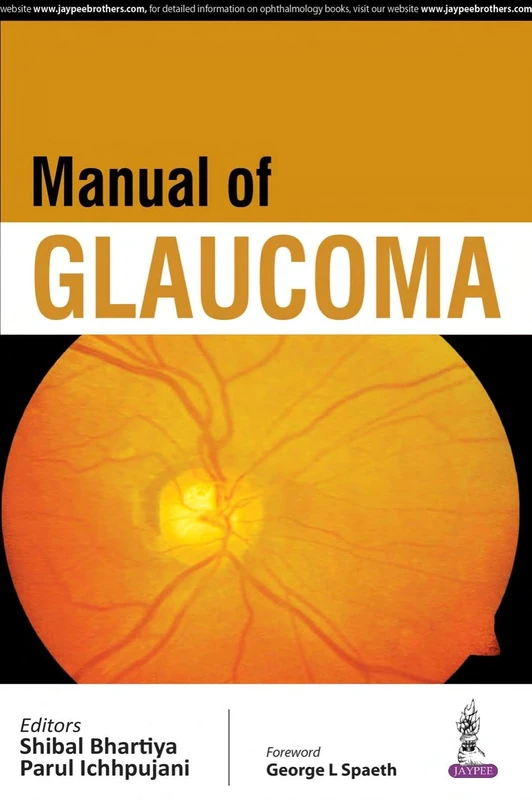 Manual of Glaucoma