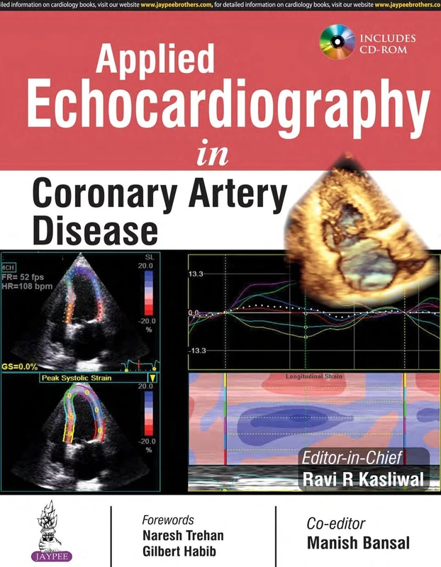 Applied Echocardiography in Coronary Artery Disease