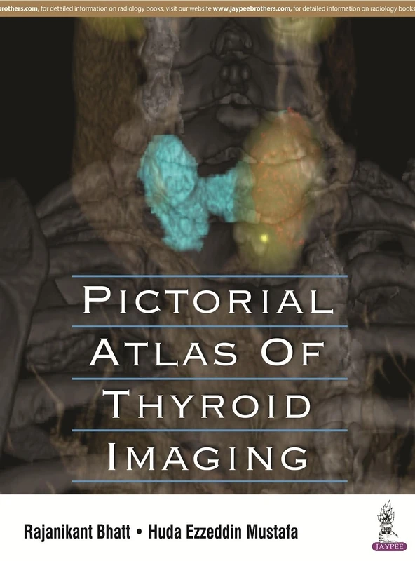 Pictorial Atlas of Thyroid Imaging - Image 1