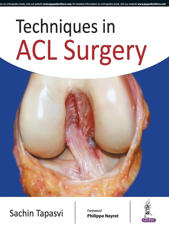 Techniques in Acl Surgery