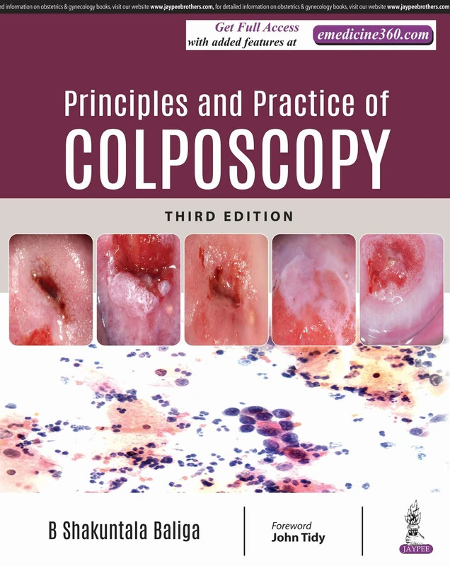 Principles and Practice of Colposcopy - Jaypee Brothers