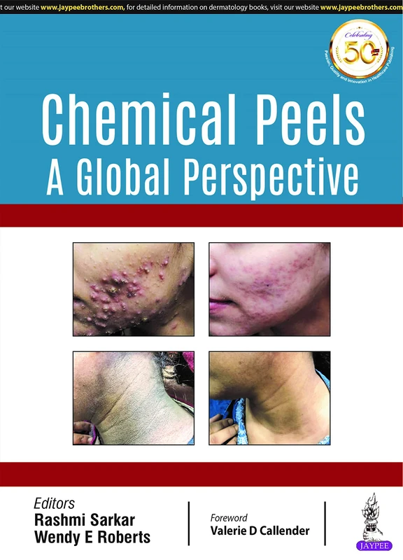 Chemical Peels: A Global Perspective