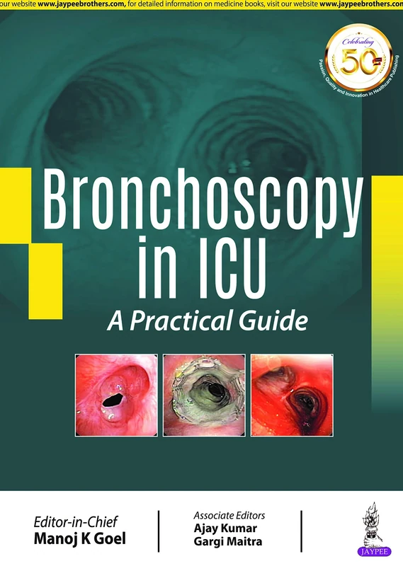 Bronchoscopy in ICU: A Practical Guide