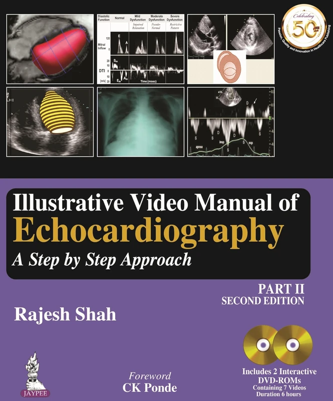 Illustrative Video Manual of Echocardiography: A Step by Step Approach - Part 2