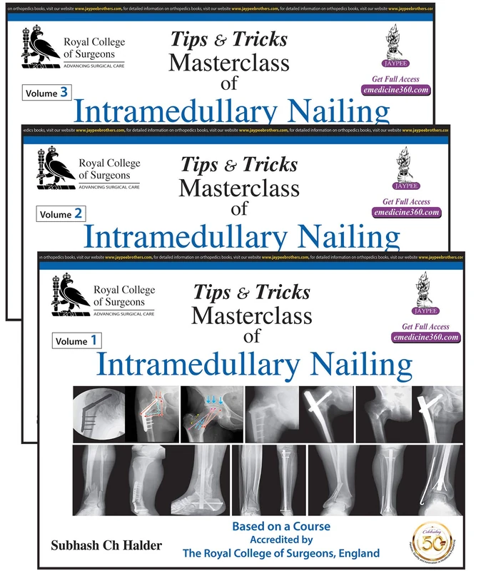 Tips and Tricks: Masterclass of Intramedullary Nailing: Three Volume Set - Image 1