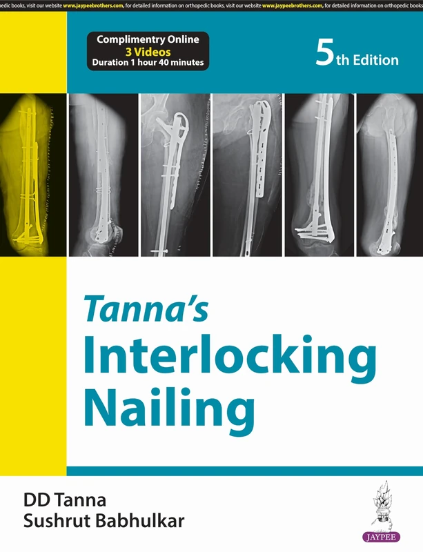 Tanna’s Interlocking Nailing - Image 1