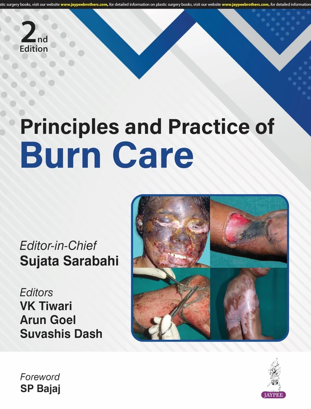 Principles and Practice of Burn Care