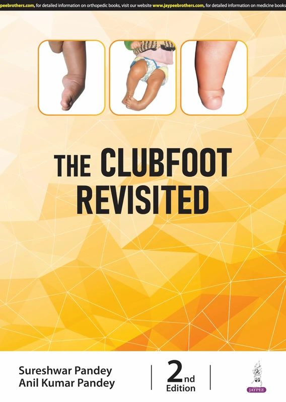 The Clubfoot Revisited