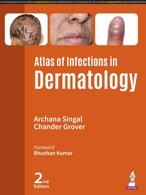 Atlas of Infections in Dermatology - Image 1