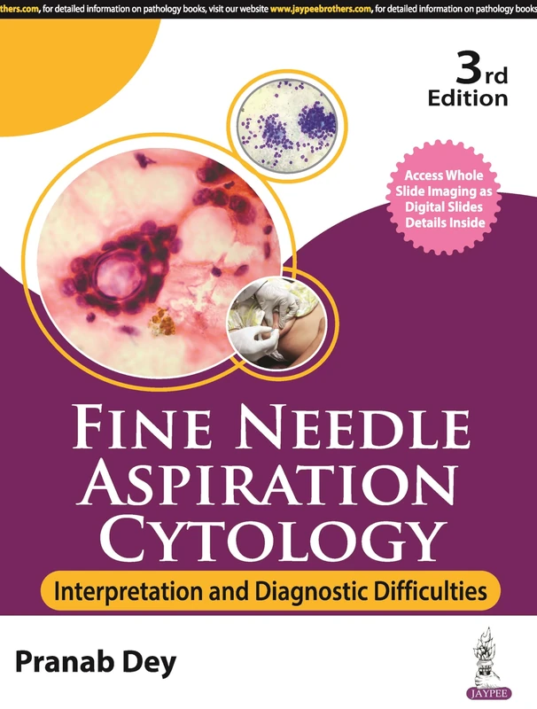 Fine Needle Aspiration Cytology: Interpretation and Diagnostic Difficulties - Image 1