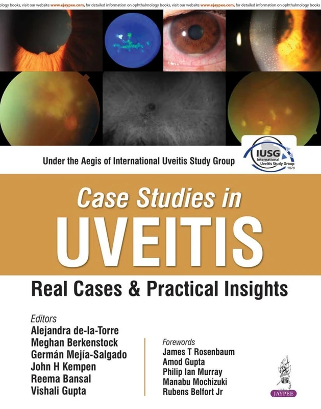 Case Studies in Uveitis: Real Cases and Practical Insights