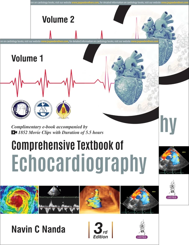 Comprehensive Textbook of Echocardiography: Two Volume Set