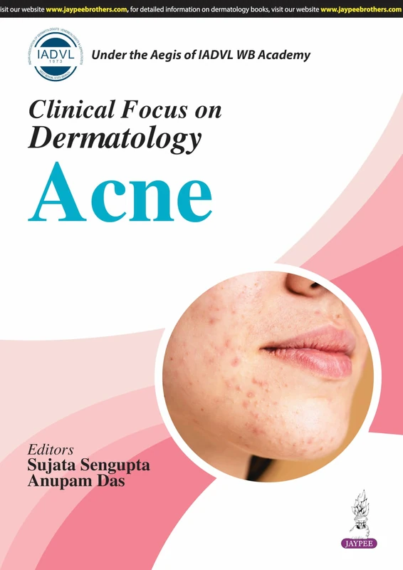 Clinical Focus on Dermatology: Acne