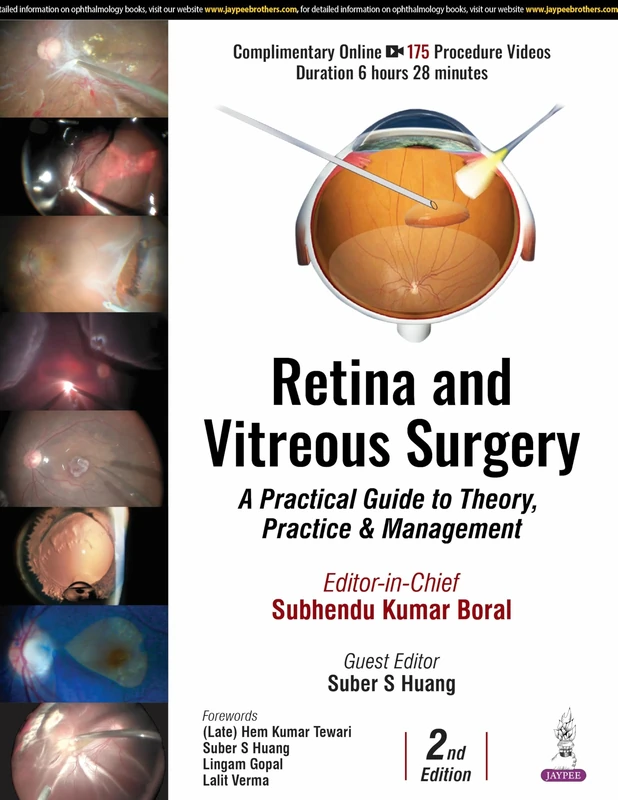 Retina and Vitreous Surgery: A Practical Guide to Theory, Practice & Management
