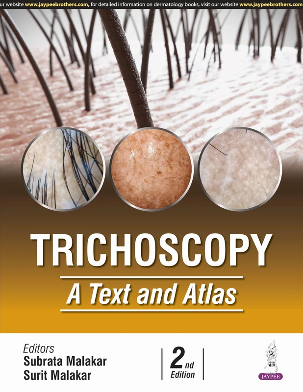 Trichoscopy: A Text and Atlas