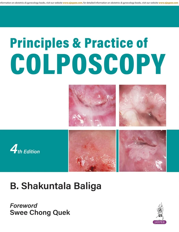 Principles and Practice of Colposcopy