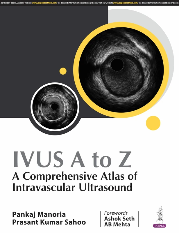 IVUS A to Z: A Comprehensive Atlas of Intravascular Ultrasound