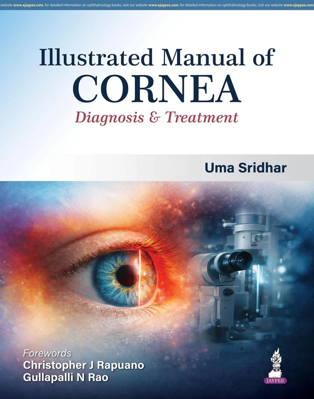 Illustrated Manual of Cornea: Diagnosis & Treatment