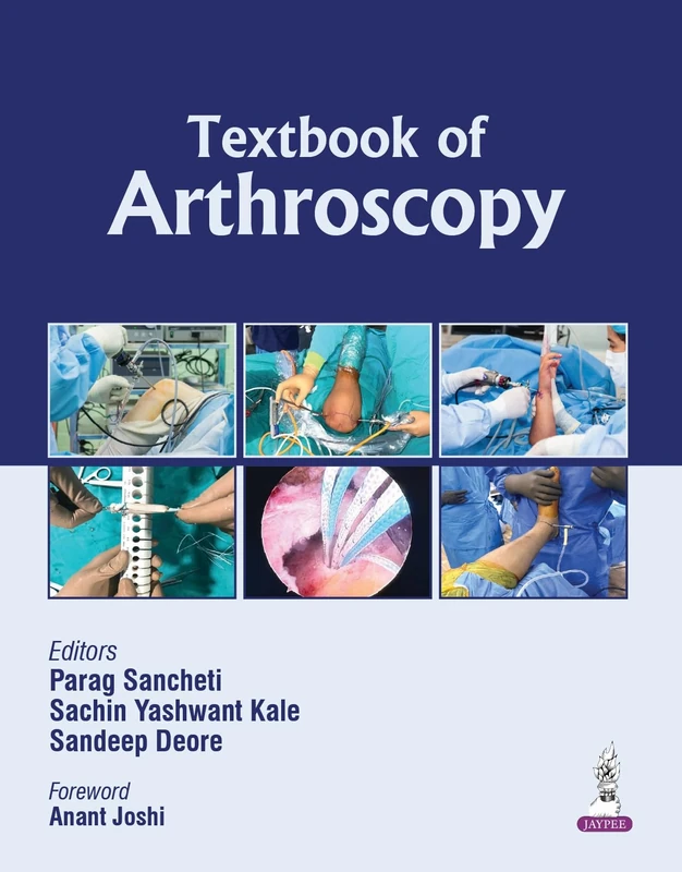 Textbook of Arthroscopy