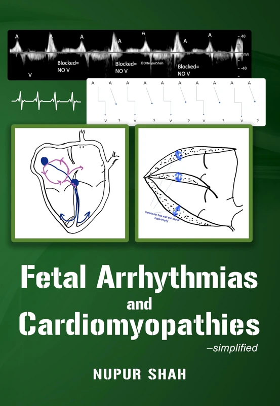 Fetal Arrhythmias and Cardiomyopathies – simplified