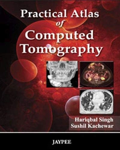 Practical Atlas of Computed Tomography - Jaypee Brothers