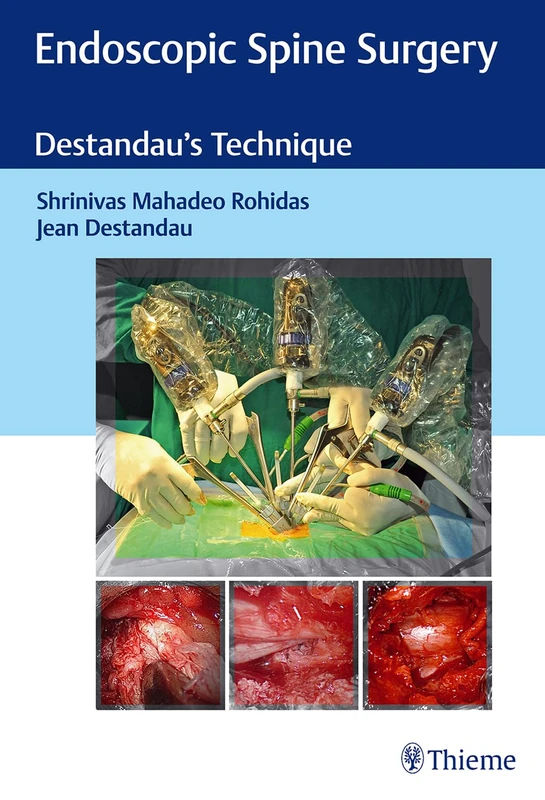 Endoscopic Spine Surgery: Destandau's Technique
