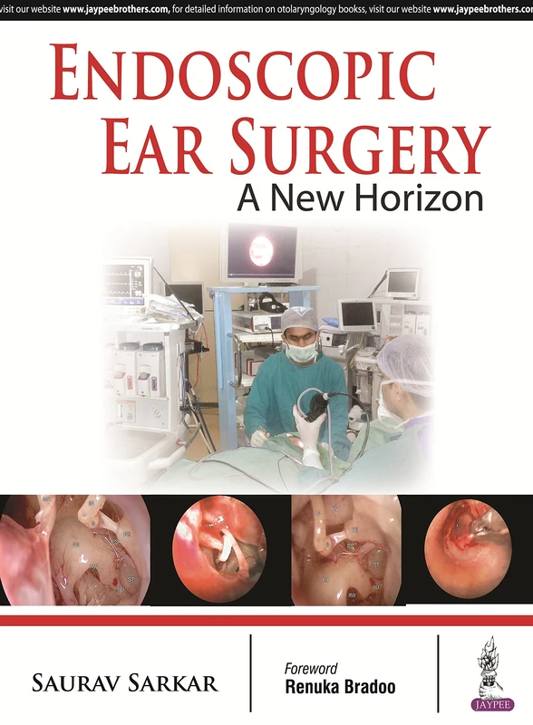 Endoscopic Ear Surgery: A New Horizon