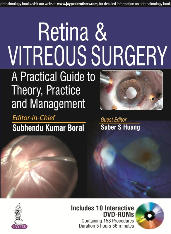 Retina & Vitreous Surgery: A Practical Guide to Theory, Practice and Management