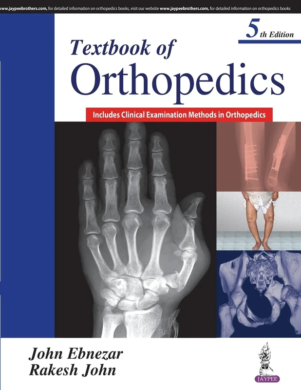 Textbook of Orthopedics