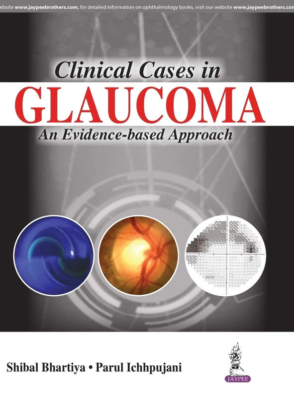Clinical Cases in Glaucoma: An Evidence Based Approach - Image 1