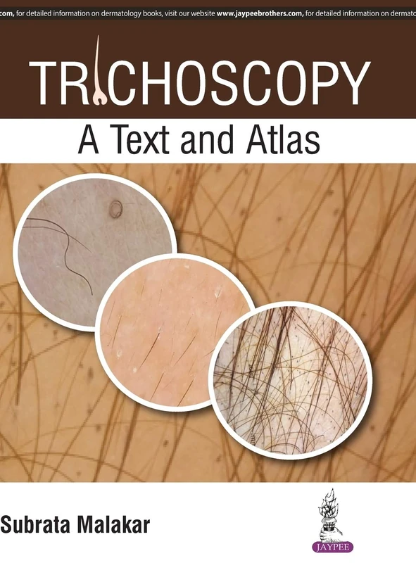 Trichoscopy - A Text and Atlas