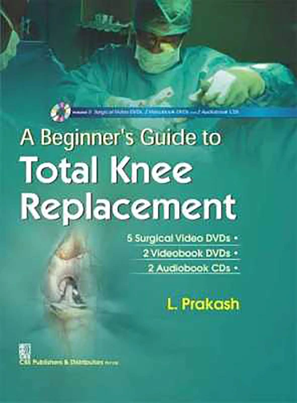CBSPD A Beginner's Guide to Total Knee Replacement Book