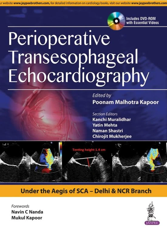 Perioperative Transeasophageal Echocarh