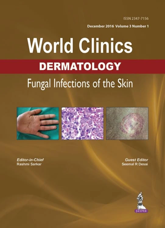 World Clinics Dermatology: Fungal Infections of the Skin Vol. 3 No. 1: Volume 3, Number 1