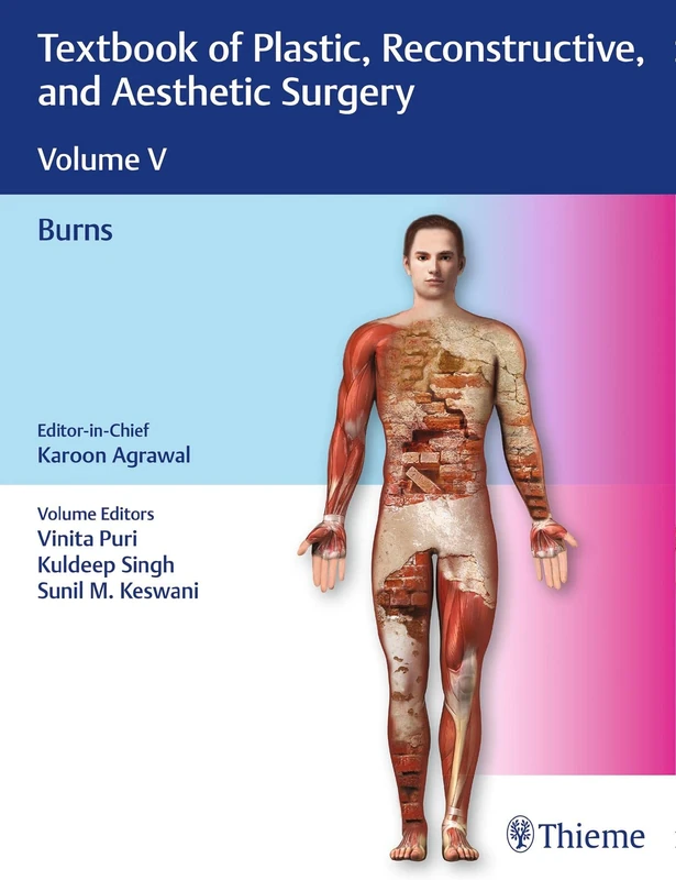 Thieme Textbook of Plastic, Reconstructive, and Aesthetic Surgery Vol 5